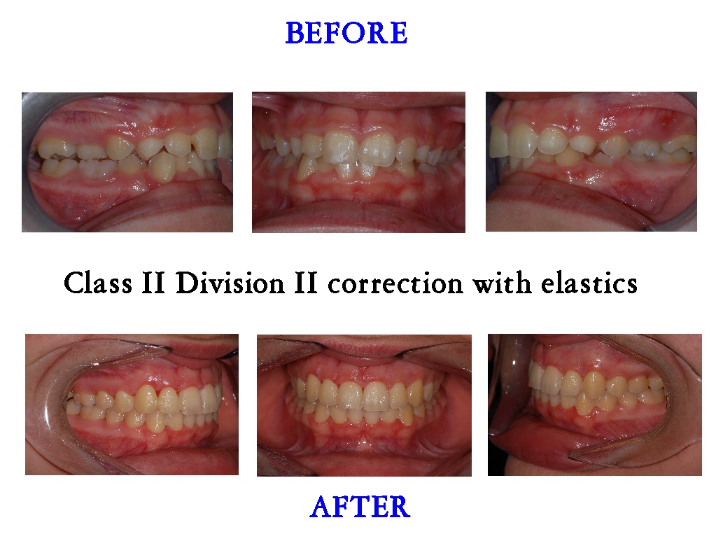 Class 2 Division 2 Correction